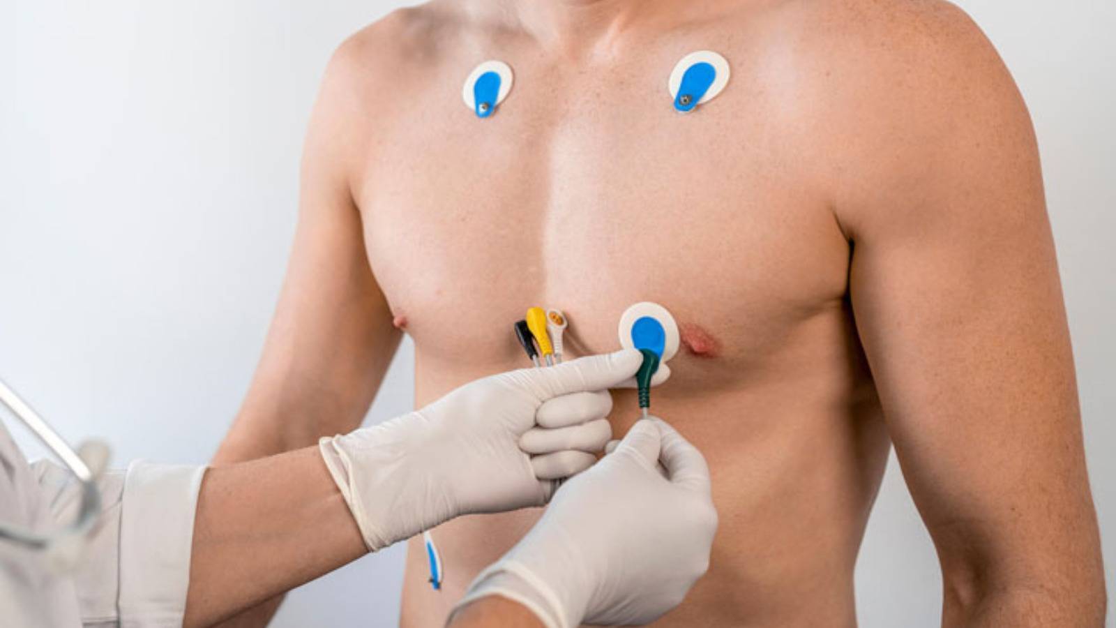 Das Akute Koronarsyndrom Das Akute Koronarsyndrom