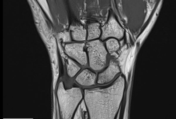 Mrt Handgelenk Muss Man Ganz In Die Röhre www.medneo.com