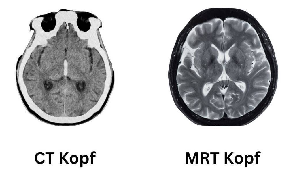 CT Kopf