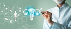 Endometriose3 1