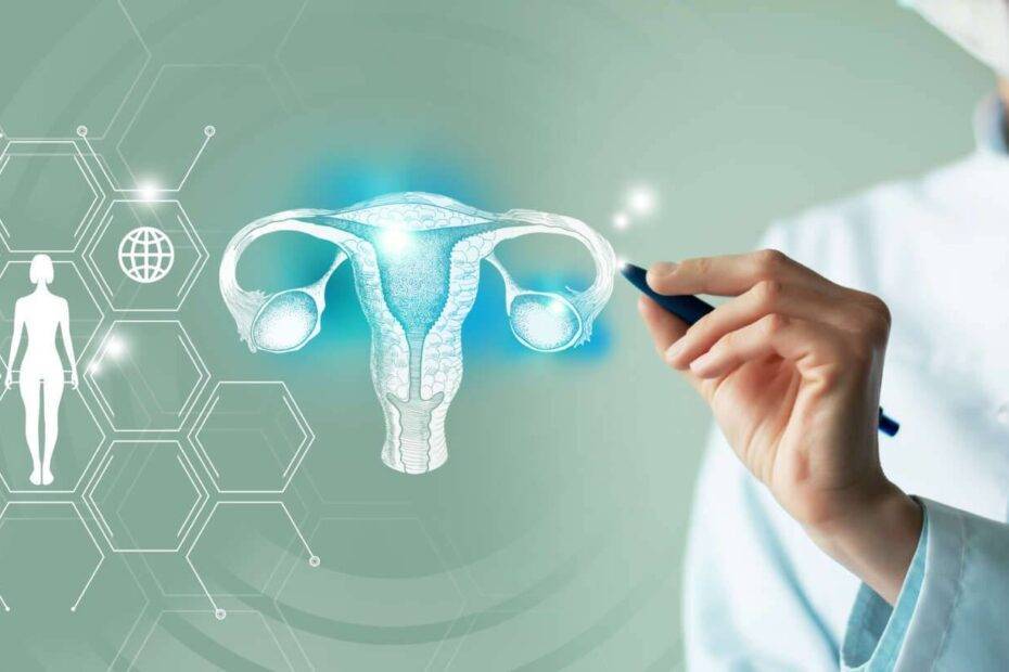 Endometriose3 1