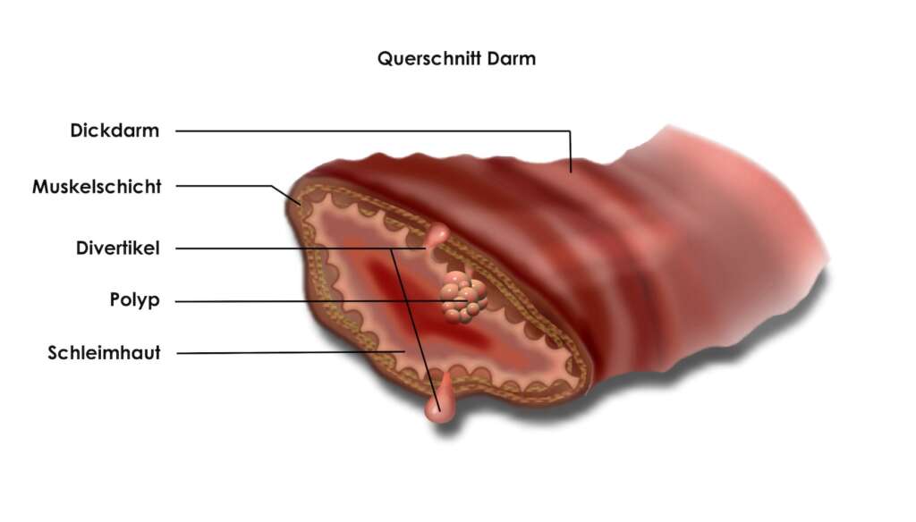 Querschnitt Darm