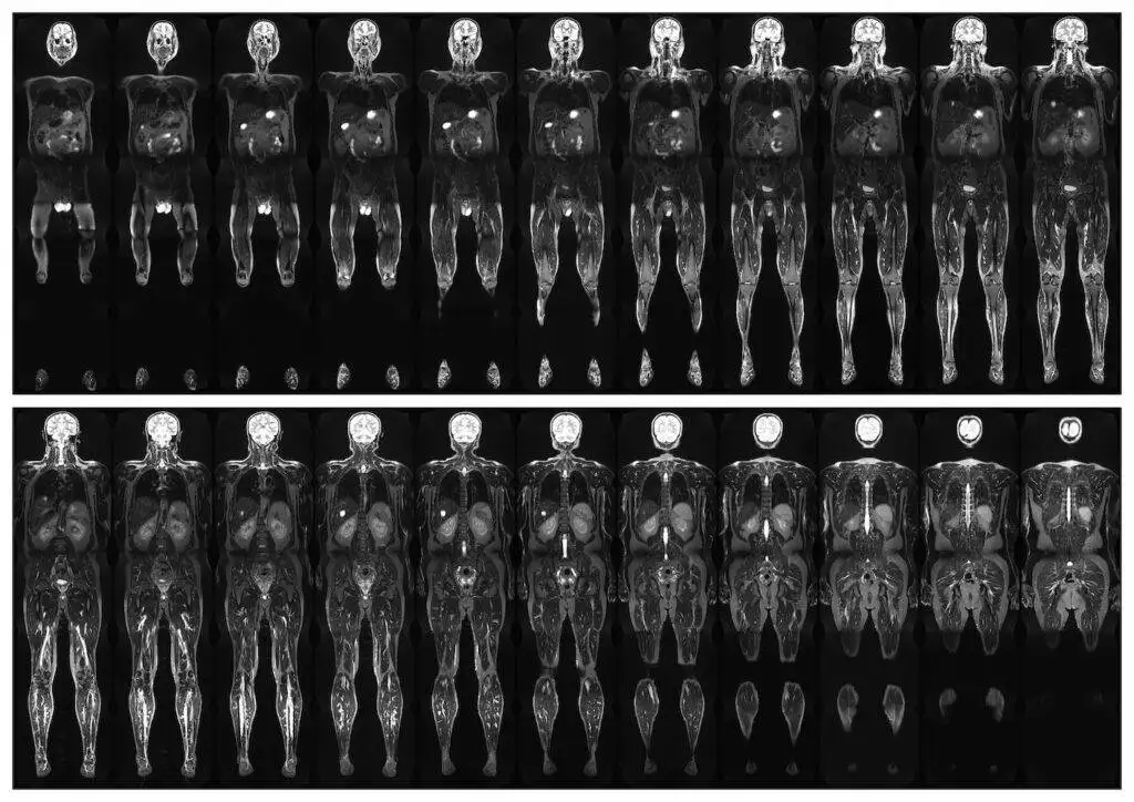 mrt-ganzkoerper-scan